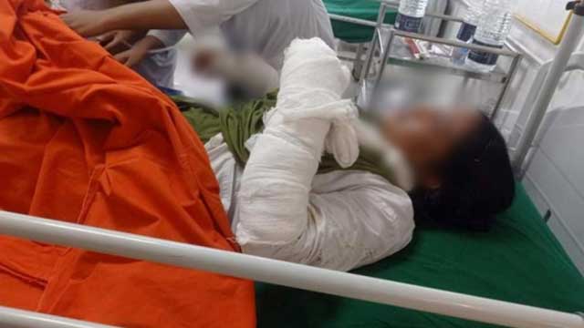 7 injured in fire at Mugda Hospital