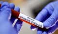 Chattogram doctor, 10 others test positive for coronavirus: Official