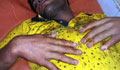 BSF pulls out finger nails of Bangladeshi man