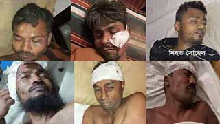 Robber’ beaten dead in Laxmipur