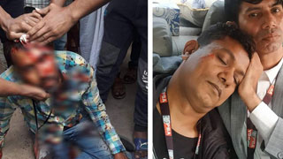 Ex-Just News BD reporter Sumon, 5 others attacked by AL men