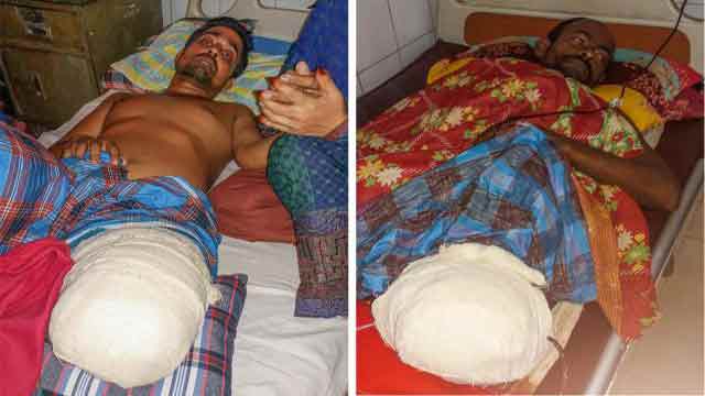 UP member, nephew’s legs amputated after torture in police custody